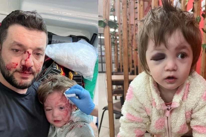 Yalova'da 14 Aylık Bebek ve Babasına Sopayla Saldırı: Şüpheli Tutuklandı