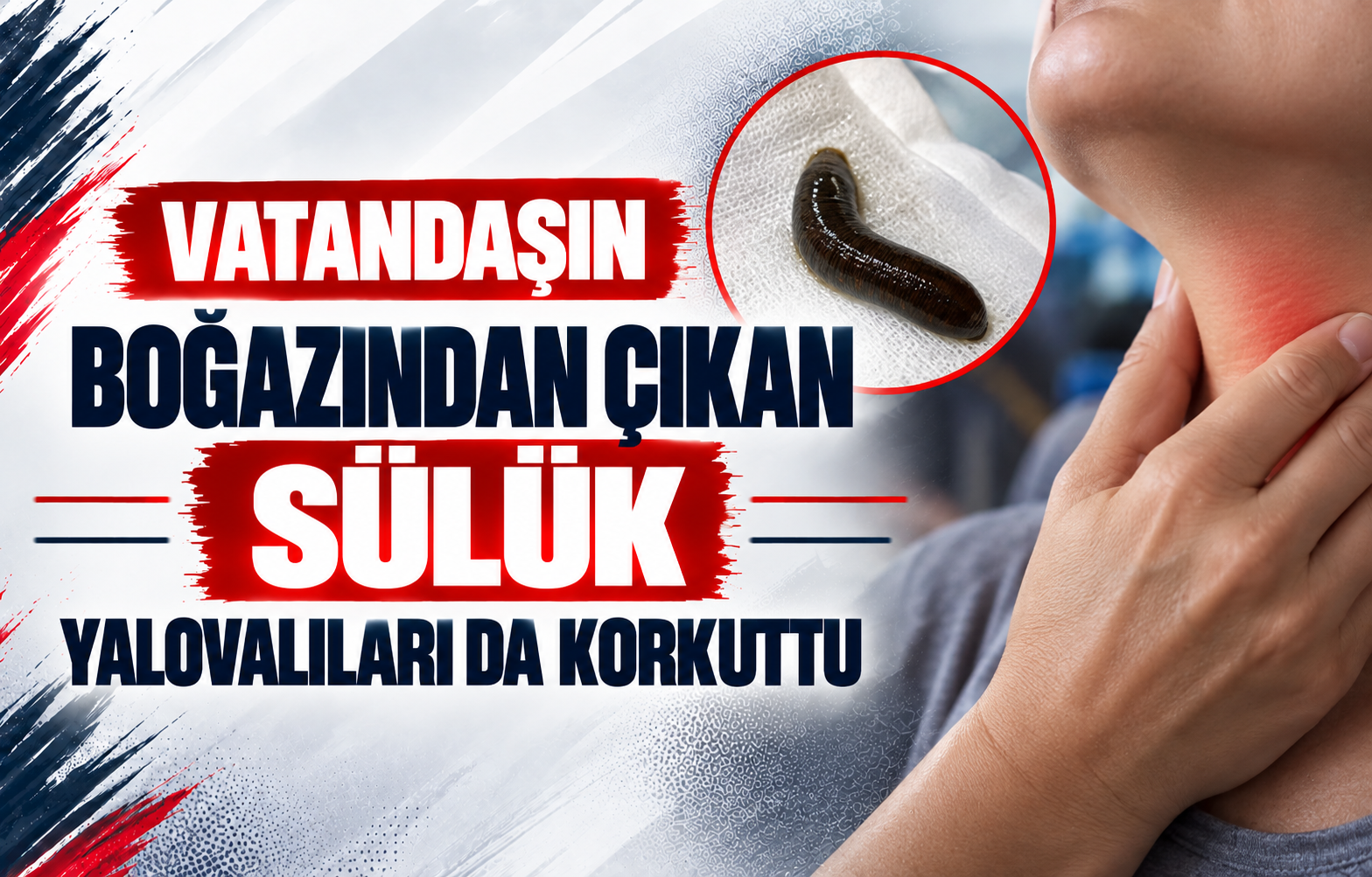 Vatandaşın Boğazından Çıkan Sülük Yalovalıları da Korkuttu