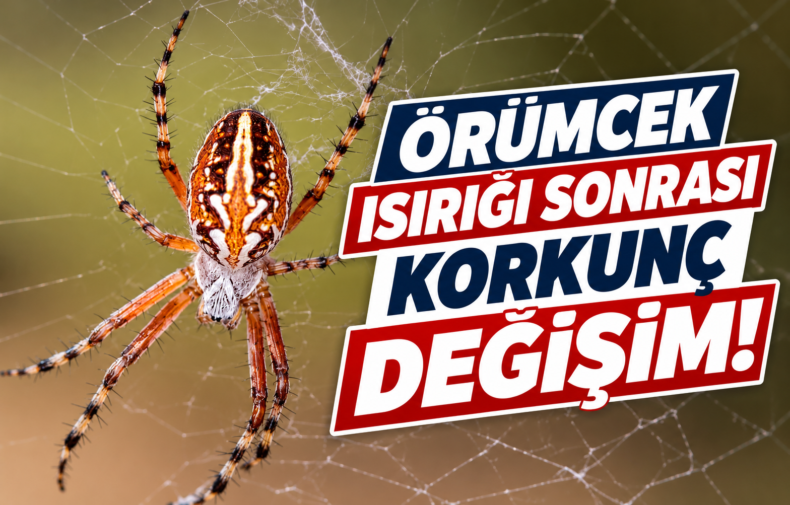 ÖRÜMCEK ISIRIĞI SONRASI KORKUNÇ DEĞİŞİM!