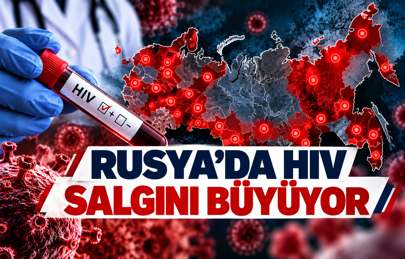 RUSYA'DA HIV SALGINI BÜYÜYOR